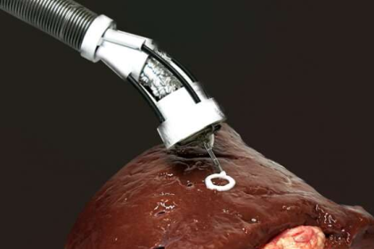 چاپ زیستی سه بعدی پرتابل